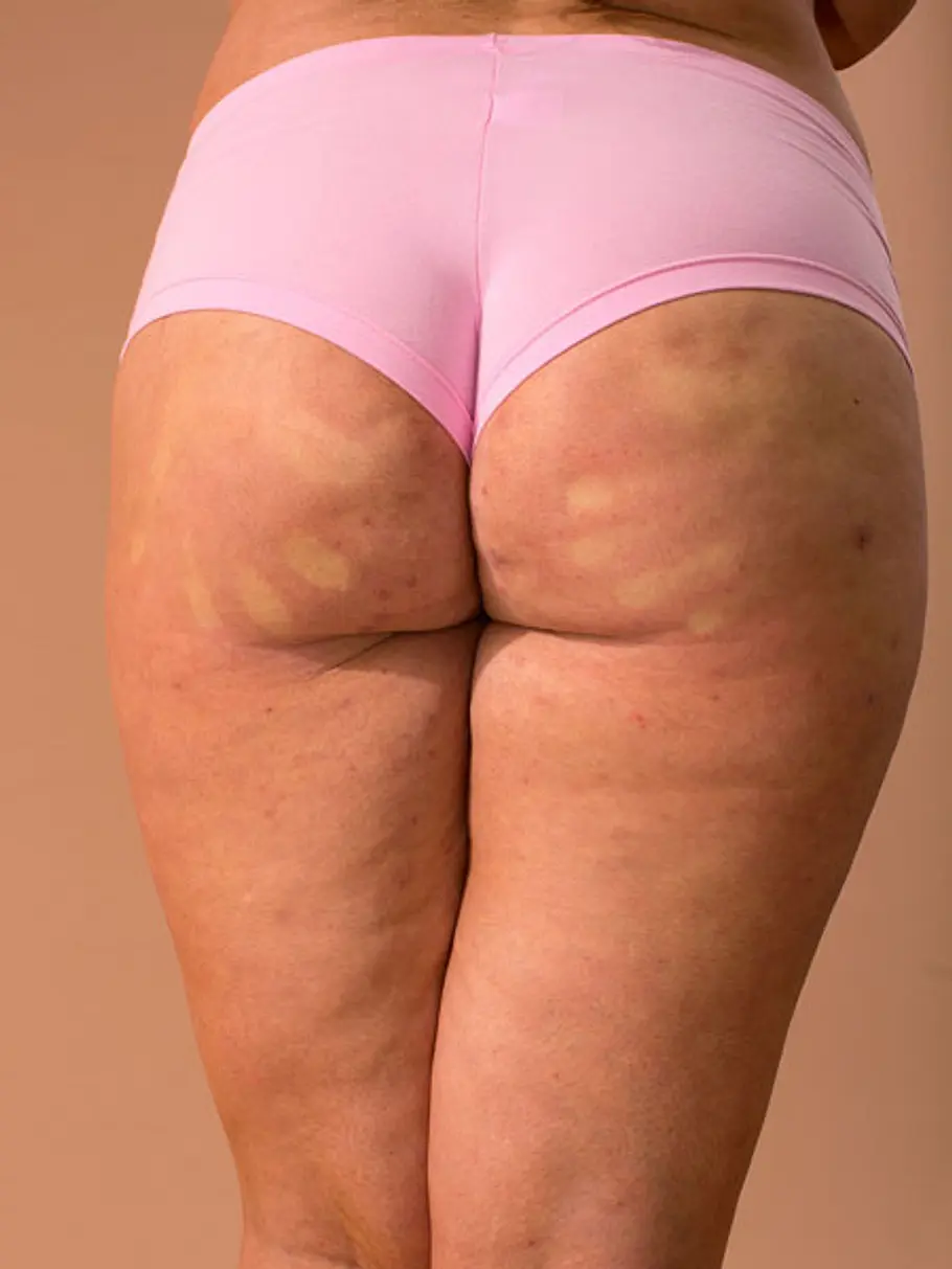 30 bilder von unretuschierten hintern handabdruck