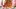 Video Platzhalter Video Platzhalter