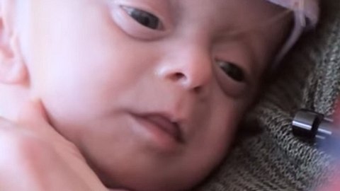 baby ohne gehirn - Foto: Screenshot / Cinepear