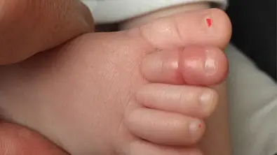 baby zeh warnung - Foto: Scott Walker / Facebook