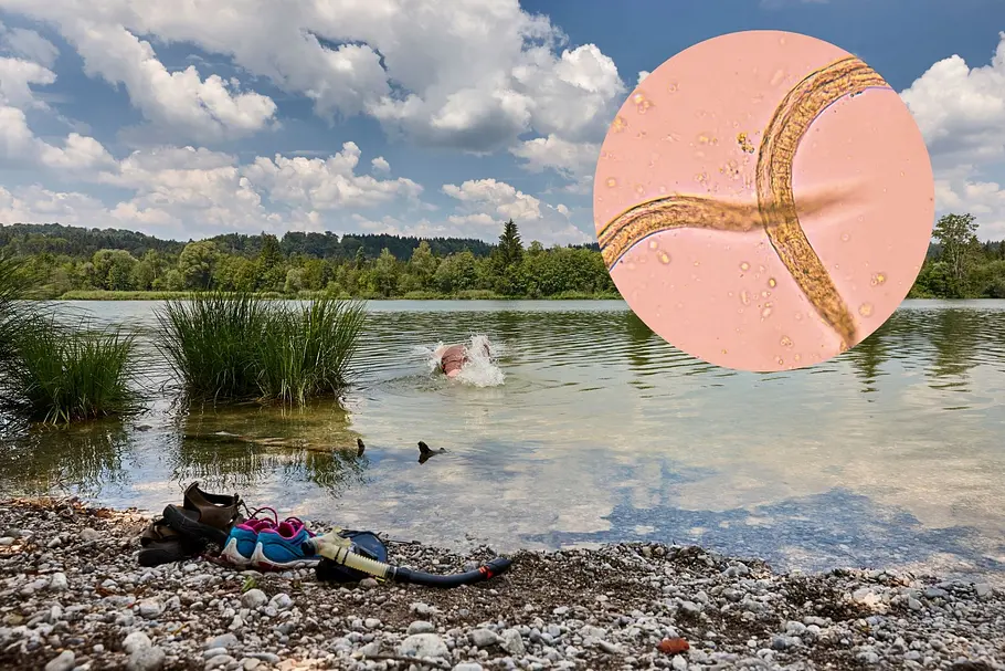Badsee-Würmer kriechen unter deiner Haut – hier besser nicht baden gehen! Ein Badesee mit Kleidung und Schuhen am Ufer. Ein Mensch schwimmt in einem Badesee.
