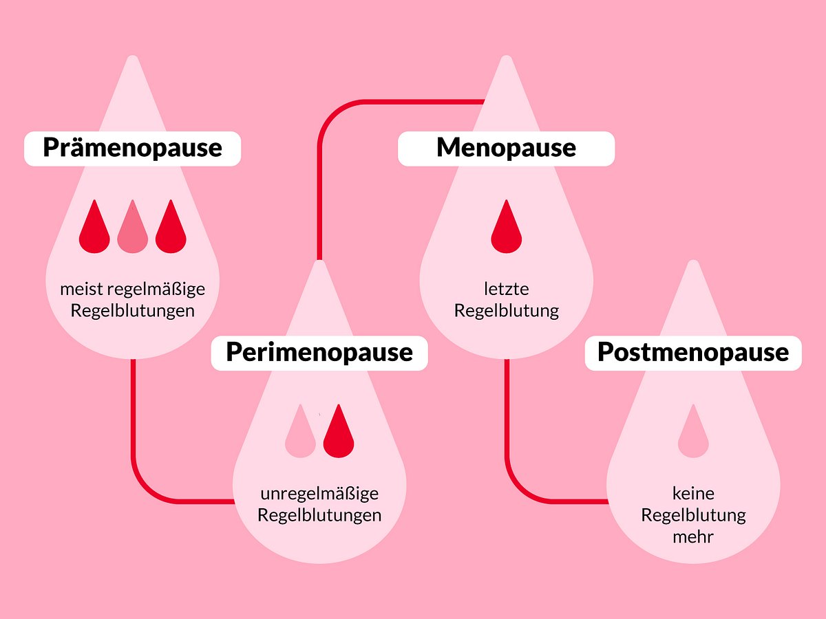 Abbildung zeigt die vier Phasen der Wechseljahre: Prämenopause, Perimenopause, Menopause und Postmenopause.