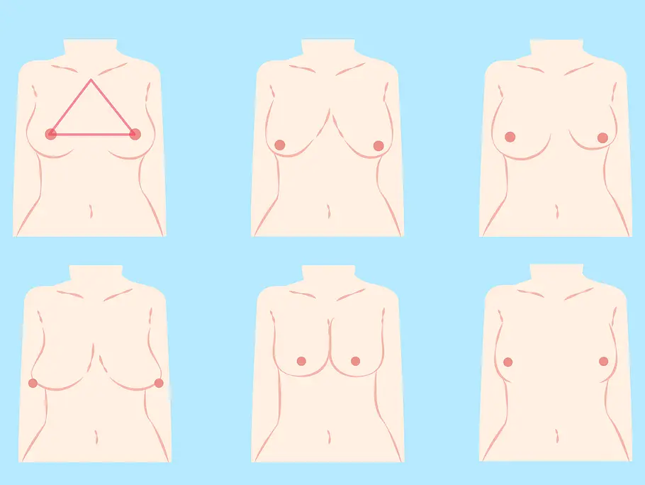 Verschiedene Brustformen Verschiedene Brustformen als Infografik