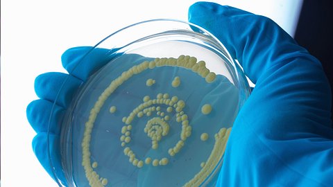 Krankmachender Pilz breitet sich aus! Was du über Candida auris wissen musst - Foto: Cultura RM Exclusive/Sigrid Gombert/Getty Images (Themenbild)