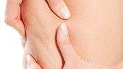 cellulite stadien - Foto: Istock