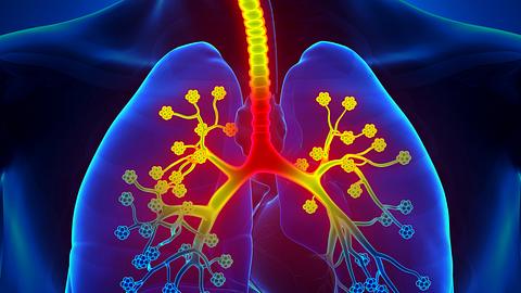 Das kannst du bei einer chronischen Bronchitis tun. - Foto: iStock/decade3d
