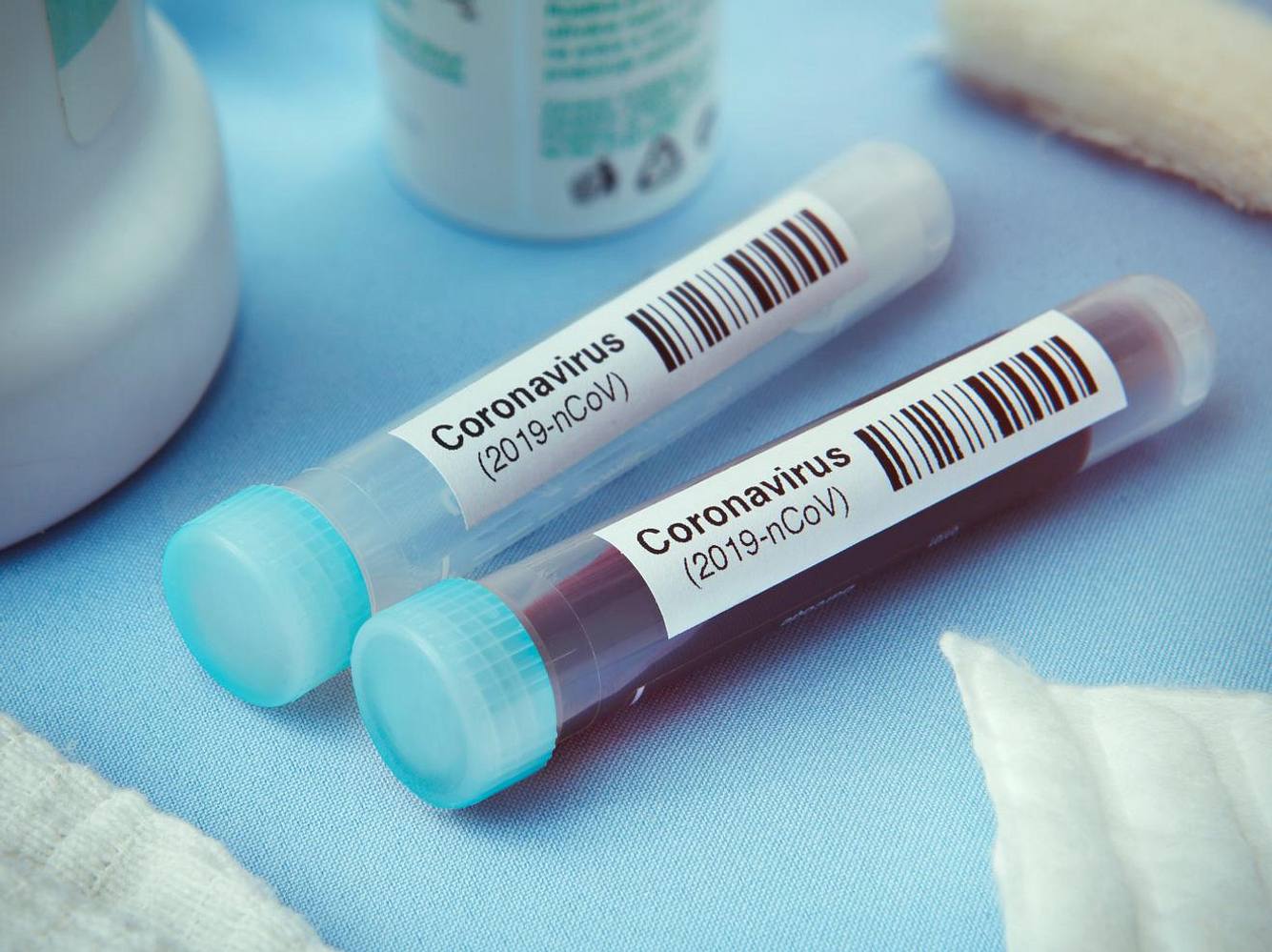 Coronavirus: Freiwillige infizieren sich für Mega-Summe mit Virus Coronavirus: Freiwillige infizieren sich für Mega-Summe mit Virus