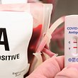Corona-Studie enthüllt: So beeinflusst die Blutgruppe das Infektionsrisiko - Foto: IMAGO/Lobeca & Getty Images/ER Productions Limited