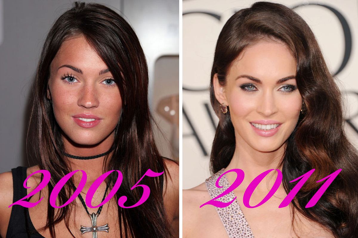 die schoenheits ops von megan fox