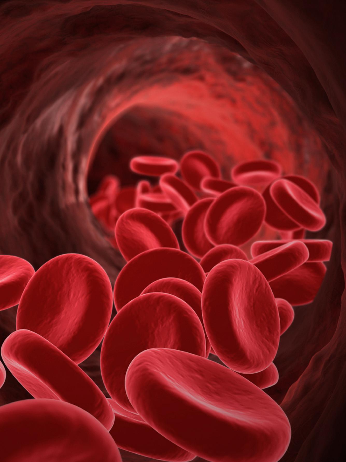 Kräuterblut oder Eisentabletten - was bei Eisenmangel wirklich hilft eisenmangel schwangerschaft kraeuterblut eisentablettenh