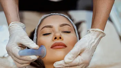 Face Cupping: Gesicht einer Frau wird geschröpft - Foto: iStock/ cream_ph 