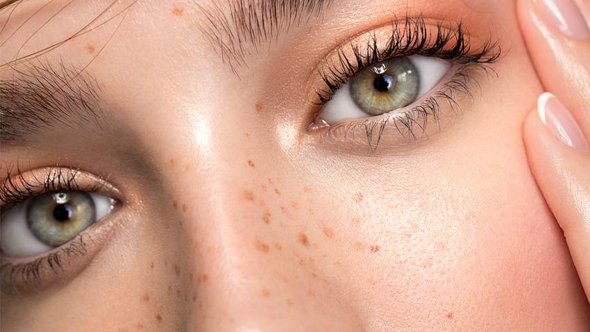 Fake Freckles: Mit diesen 5 Tipps kannst du dir falsche Sommersprossen schminken! - Foto: svetikd/iStock