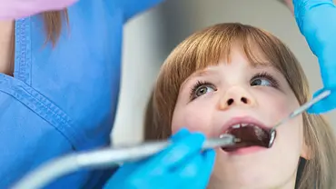Fluorose: Dentalfluorose kann weiße Flecken auf den Zähnen verursachen (Symbolbild) - Foto: PIKSEL/iStock (Symbolbild) Fluorose: Dentalfluorose kann weiße Flecken auf den Zähnen verursachen (Symbolbild) - Foto: PIKSEL/iStock (Symbolbild)