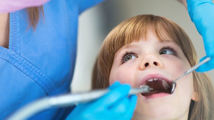 Fluorose: Dentalfluorose kann weiße Flecken auf den Zähnen verursachen (Symbolbild) - Foto: PIKSEL/iStock (Symbolbild)