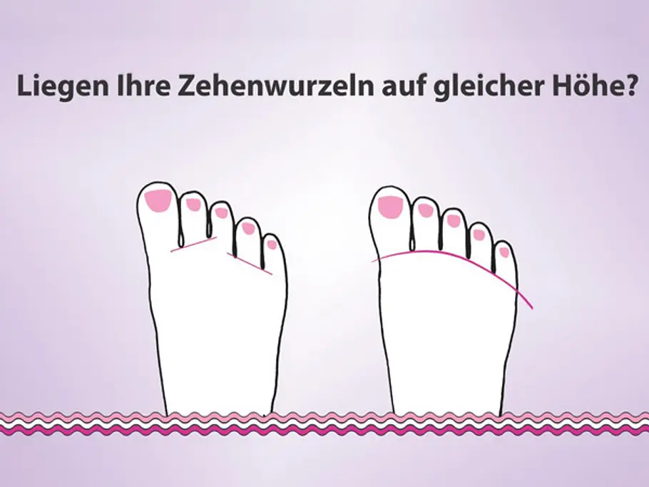 Fußdiagnose: Die Bedeutung der Zehenwurzeln