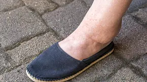 Geschwollene Füße in einem dunklen Schuh (Themenbild) - Foto: Ralf Geithe/iStock Geschwollene Füße in einem dunklen Schuh (Themenbild) - Foto: Ralf Geithe/iStock