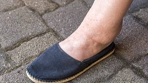 Geschwollene Füße in einem dunklen Schuh (Themenbild) - Foto: Ralf Geithe/iStock