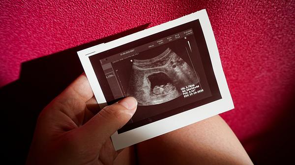 Ausgedrucktes Ultraschallbild eines Fötus in einer Hand vor einer roten Wand (Themenbild) - Foto: photographer/iStock