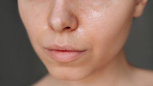 Frau mit stark glänzender Haut im Gesicht - Foto: iStock/ Marina Demeshko 