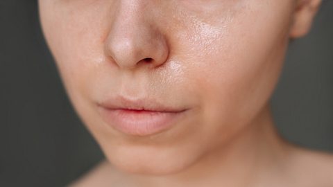 Frau mit stark glänzender Haut im Gesicht - Foto: iStock/ Marina Demeshko 