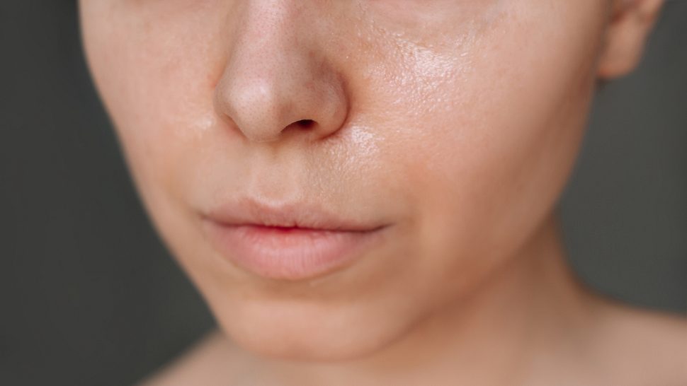 Frau mit stark glänzender Haut im Gesicht - Foto: iStock/ Marina Demeshko 