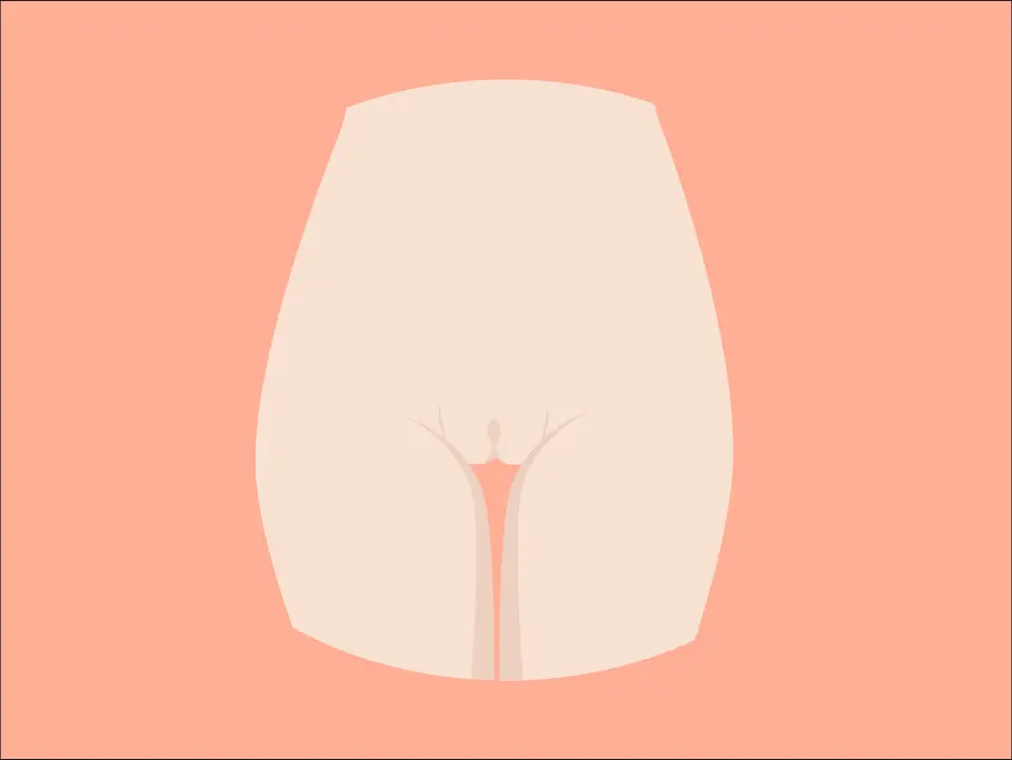 Grafik Vulva-Form Horseshoe