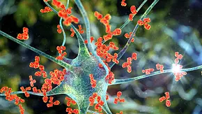 Guillain-Barré-Syndrom: Schwere neurologische Erkrankung - Erfahrungsbericht und Folgeschäden - Foto: Dr_Microbe/iStock Guillain-Barré-Syndrom: Schwere neurologische Erkrankung - Erfahrungsbericht und Folgeschäden - Foto: Dr_Microbe/iStock