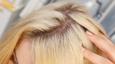 So kaschierst du ganz einfach deinen Haaransatz. - Foto: Anetlanda/iStock