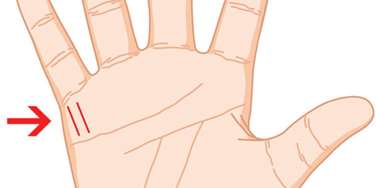 Handlinien lesen: Wie viele Kinder werde ich einmal haben? Eine rechte Hand ist abgebildet. Links unterhalb des kleinen Fingers sind zwei Handlinien eingezeichnet.