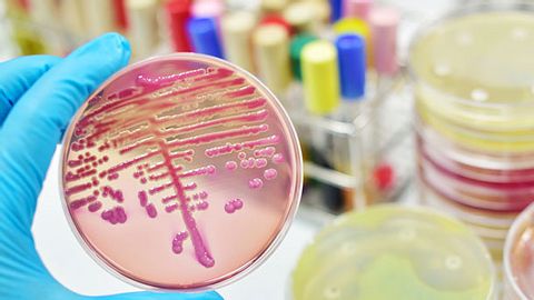 Hirnhautentzündungs-Symptome kannst du erkennen. Dann sollte es allerdings schnell gehen. - Foto: iStock