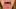 Video Platzhalter Video Platzhalter