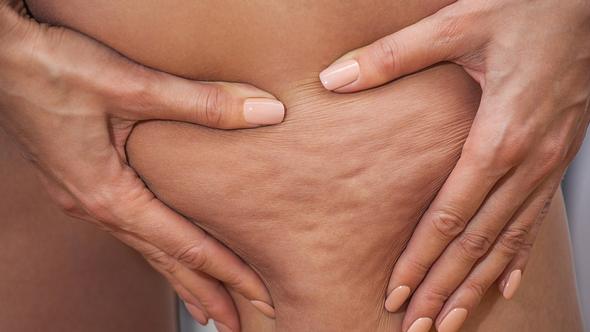 Lipomassage: Weniger Cellulite, straffe Haut und Fettreduktion - Foto: iStock