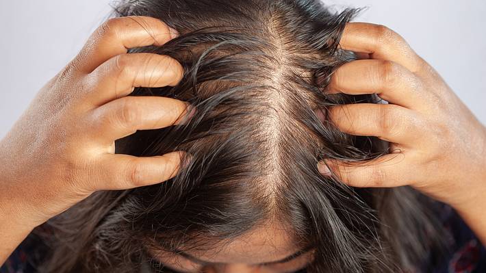 Frau kratzt sich die Kopfhaut (Themenbild) - Foto: Dharmapada Behera/iStock