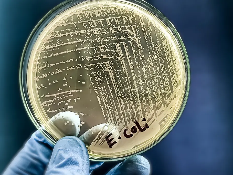 Käse-Rückruf wegen Verdacht auf E.coli - Bakterien Eine mikrobiologische Kultur Petrischale mit einer Kolonie des pathogenen Bakteriums Escherichia coli (E. coli)