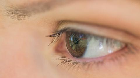 augen entzuendung - Foto: iStock