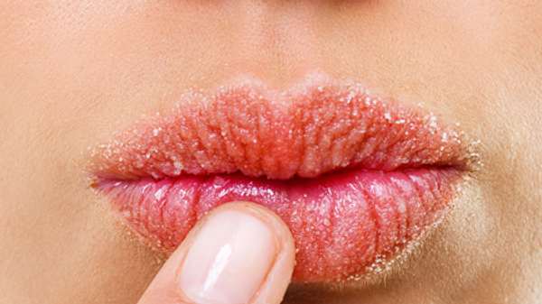 lippen trocken dexpanthenol - Foto: Istock