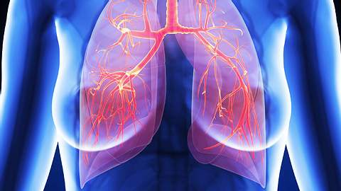 Lungenhochdruck - Pulmonale Hypertonie - Foto: iStock