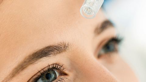 Microneedling Pen - Foto: GettyImages/Nastasic