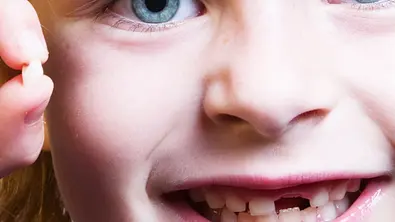 Milchzähne können Leben retten - Foto: iStock