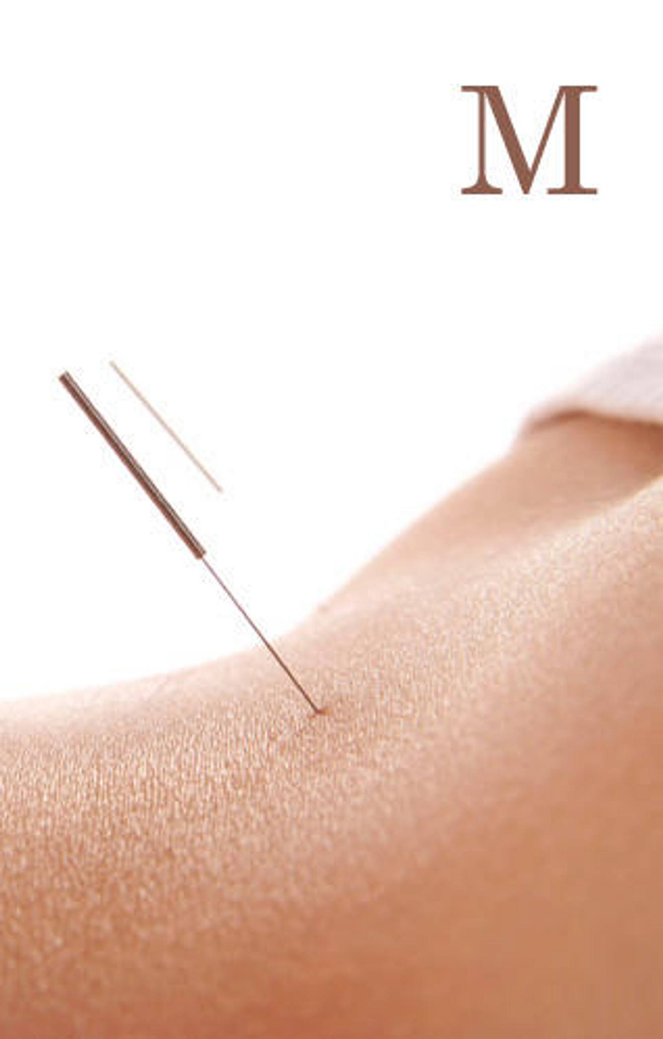 Moxibustion moxibustion