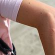 Frau hat Mückenstich am Arm - Foto: tupungato/iStock