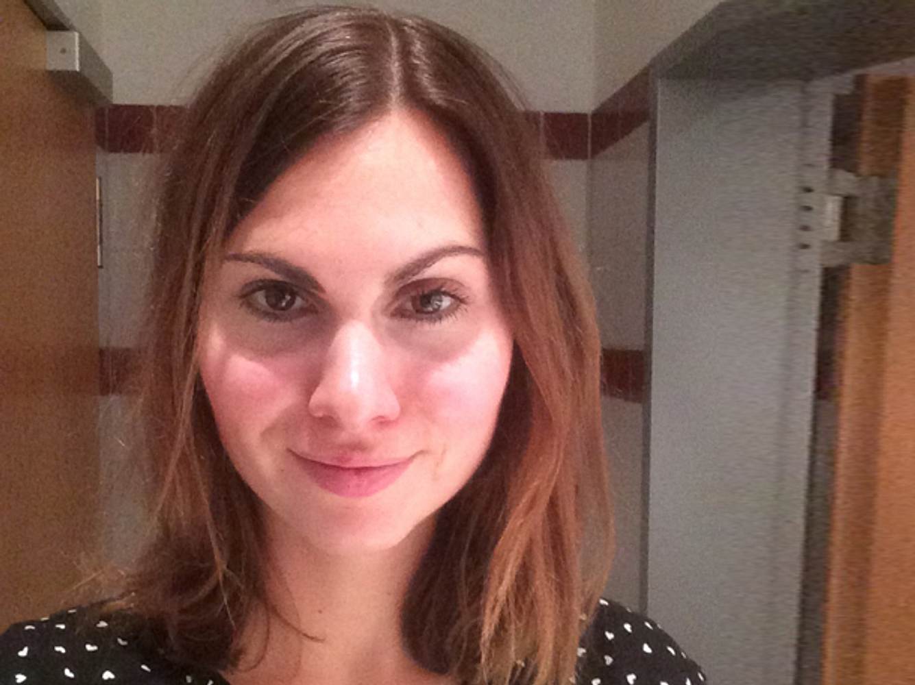 Hydra Facial nach 2 Tagen Hydra Facial nach 2 Tagen