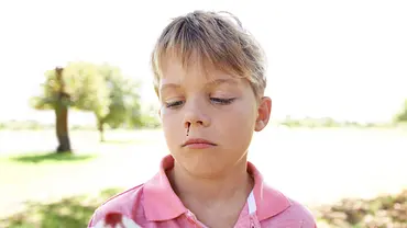 Nasenbluten bei Kindern - Foto: iStock Nasenbluten bei Kindern - Foto: iStock