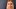 Nicole Görg nach der missglückten der OP. - Foto: Privat
