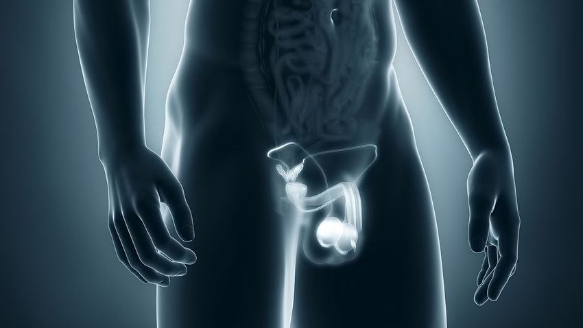 Eine Penisverkrümmung, kurz IPP, kann sehr schmerzhaft sein und den Sex tatsächlich unmöglich machen. (Themenbild) - Foto: janulla/iStock