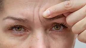 Nahaufnahme von Augen und Stirn einer Frau, sie zeigt auf ihre Zornesfalte - Foto: istock/ Tatiana Foxy Nahaufnahme von Augen und Stirn einer Frau, sie zeigt auf ihre Zornesfalte - Foto: istock/ Tatiana Foxy
