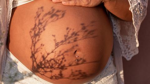 Pigmentflecken in der Schwangerschaft - Foto: iStock/ Marta Nogueira