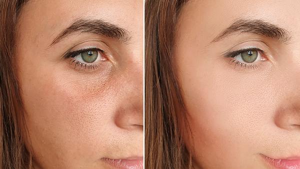 Vorher-Nachher-Bild einer jungen Frau - Foto: iStock/ TanyaLovus
