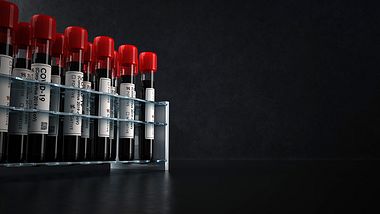 Radiomoderator stirbt an Corona - Foto: iStock/style-photography