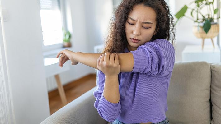 Raue Ellenbogen: Ursachen, Tipps und die richtige Pflege - Foto: iStock/ stefanamer 